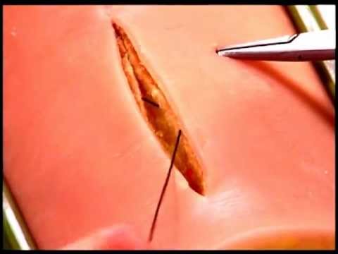  الخياطة التجميلية